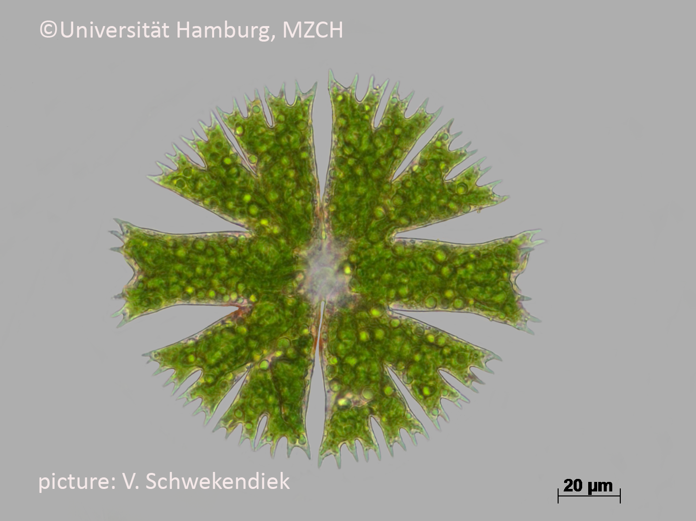 71_Micrasterias papillifera_400x_6a_a_V.Schwekendiek.bmp